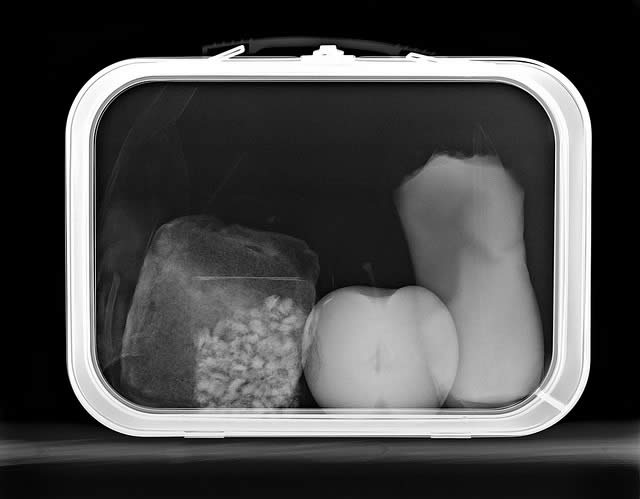 X-ray Lunchbox