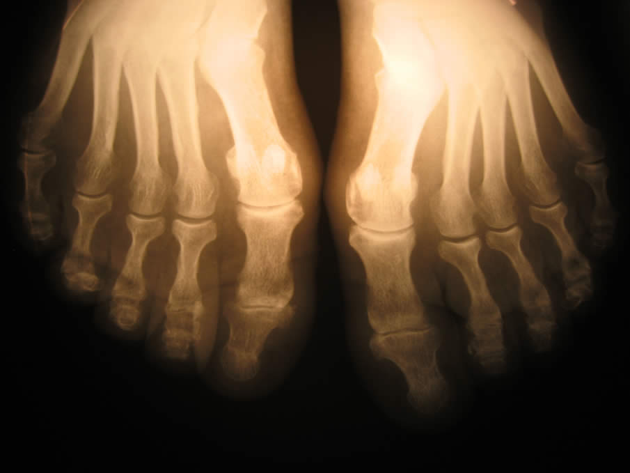 X-Ray Feet