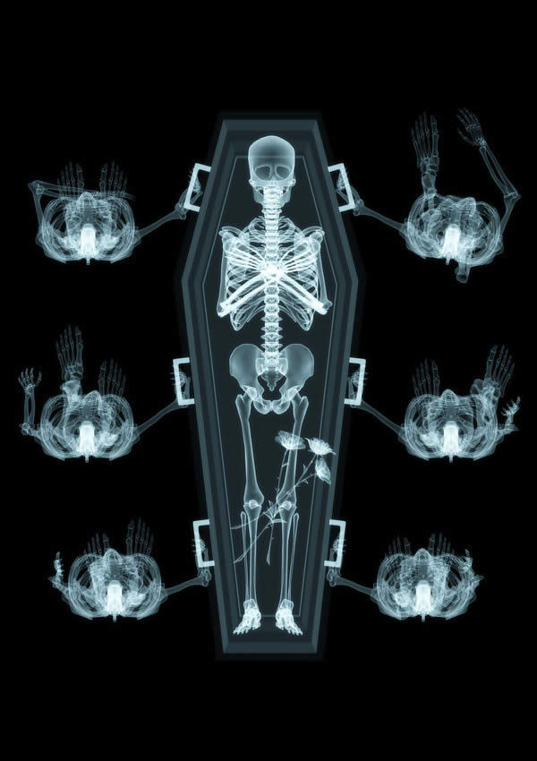 X-Ray Dead