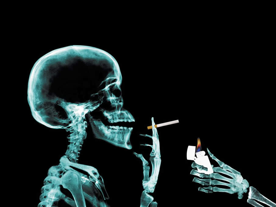 Smoking X-Ray