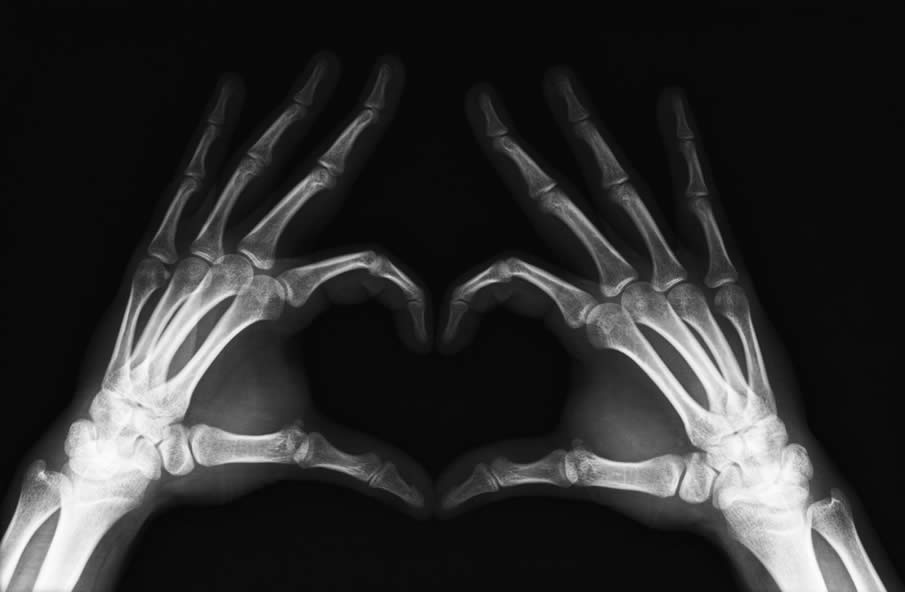 X-Ray Heart