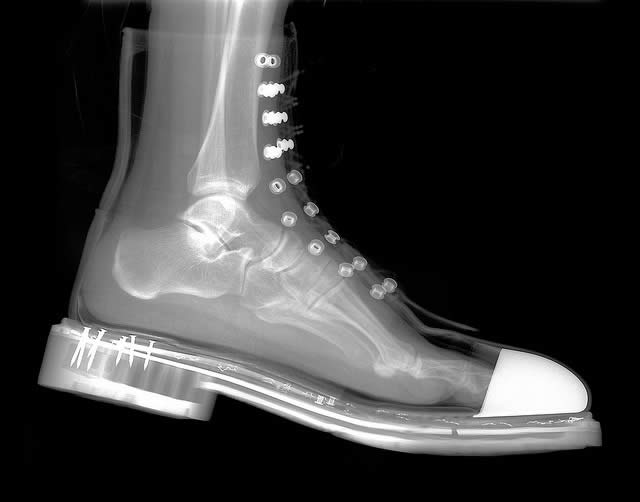 X-Ray Boot