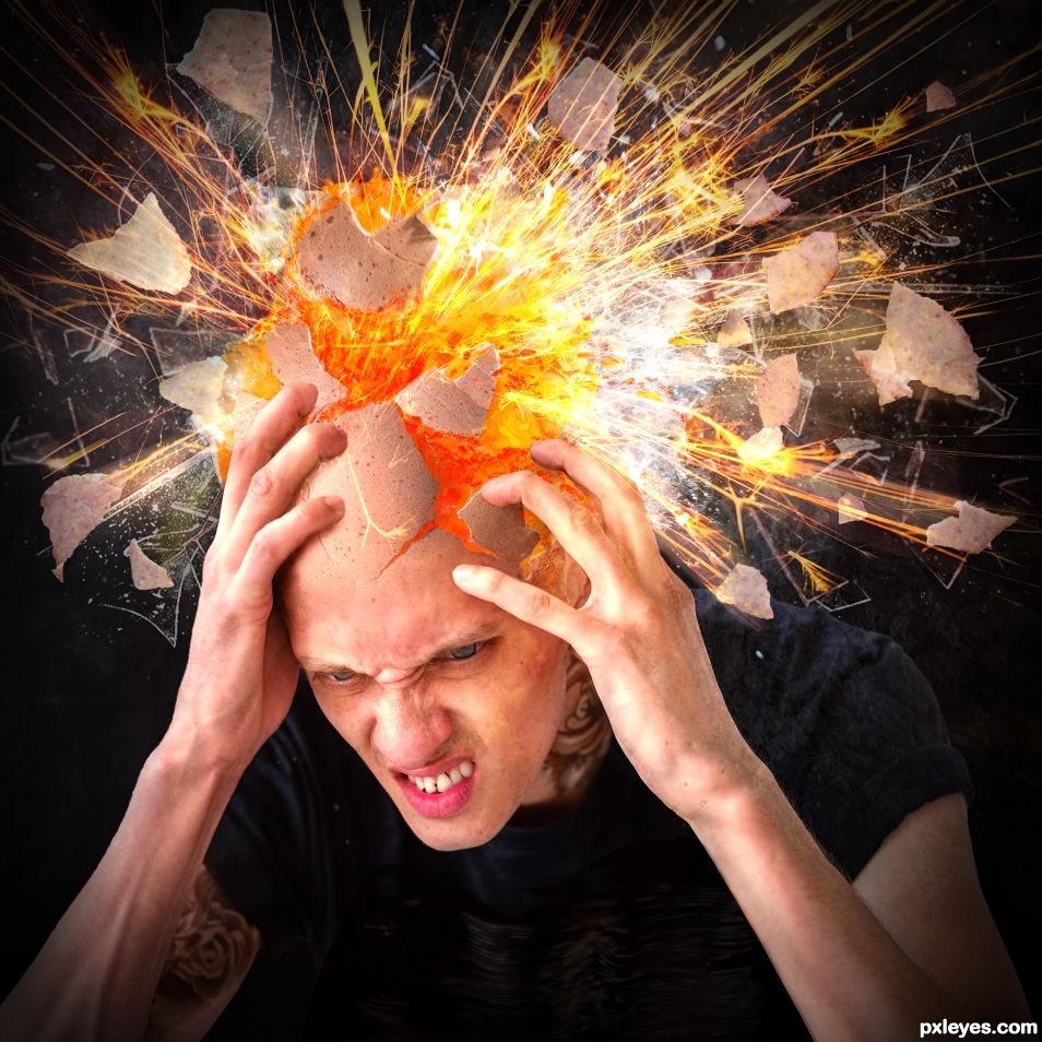 Exploding Migraine