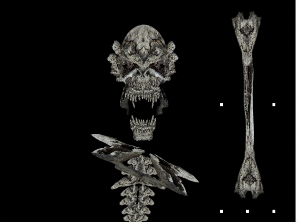Creation of Bones: Step 9