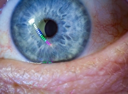 Eye Sir