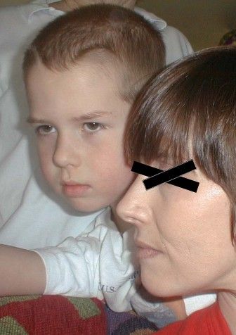 Creation of Baby Face Kiss: Step 1