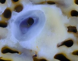 Bracket Fungus Opening