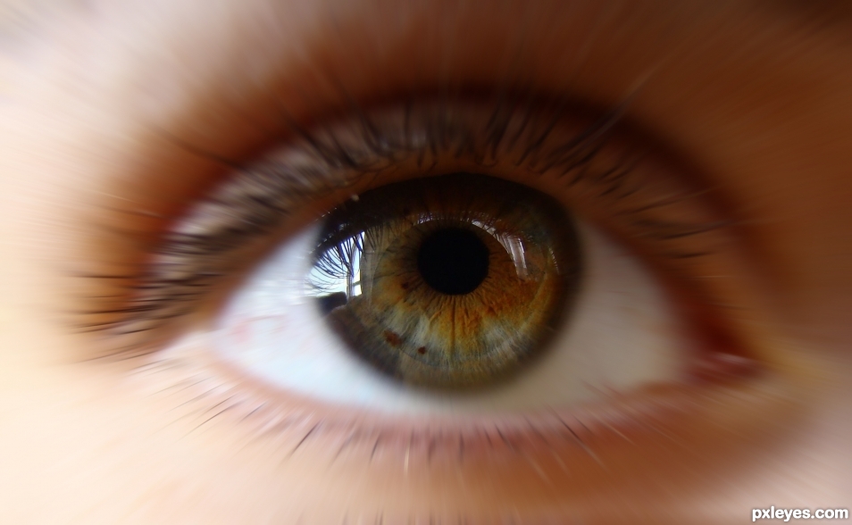heterochromia 