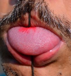 Magic-tongue piercing 
