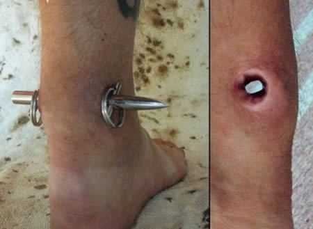 Foot Piercing Picture